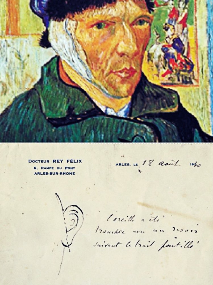 The Mystery of Van Gogh's Ear (2016)